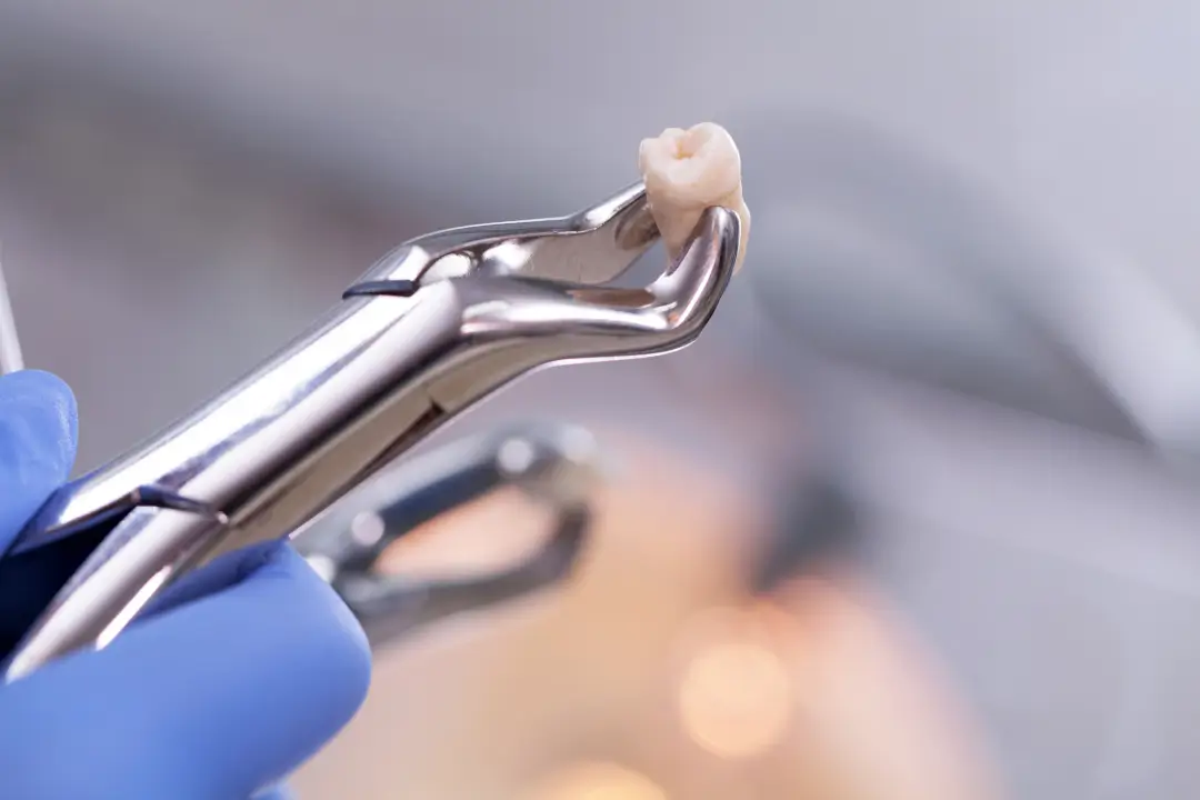 Oral Surgery 