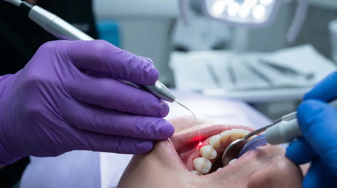 Laser Dentistry