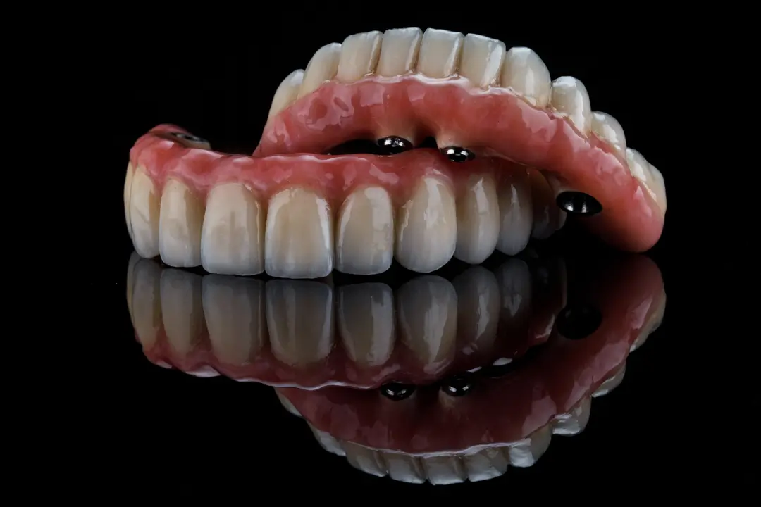 All-on-4 implants